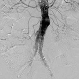 Vascular Surgery
